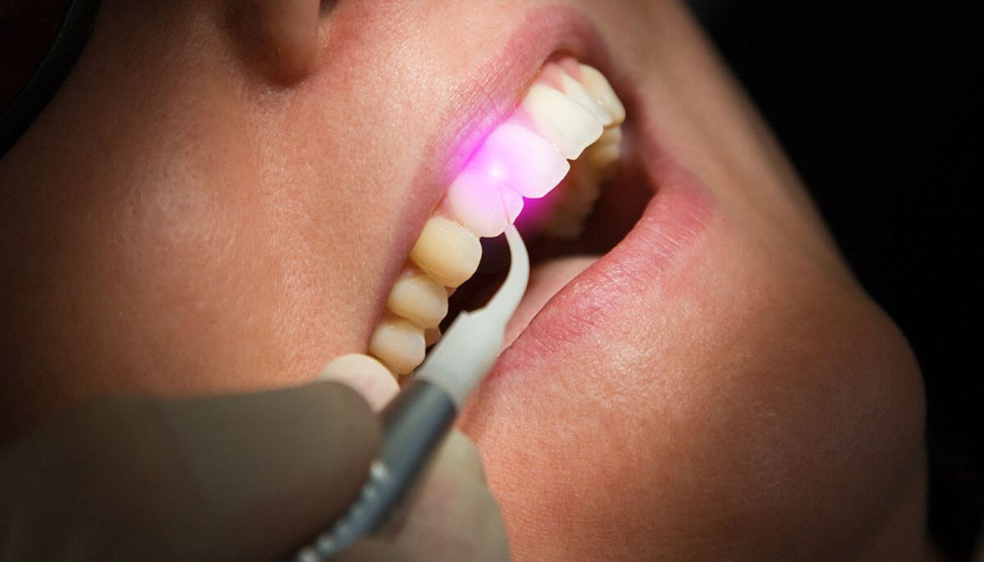 Odontoiatria conservativa